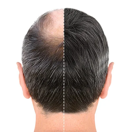 Saç Ekimi Kliniği Nasıl Araştırılmalıdır ?